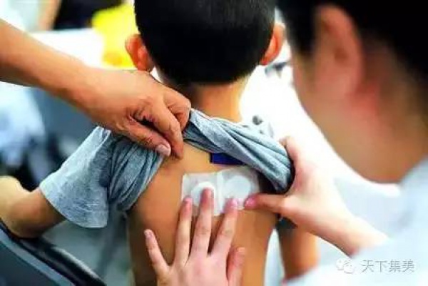 又到一年“三伏灸”，市二院今起開(kāi)始預(yù)約，還有這些地方可約！