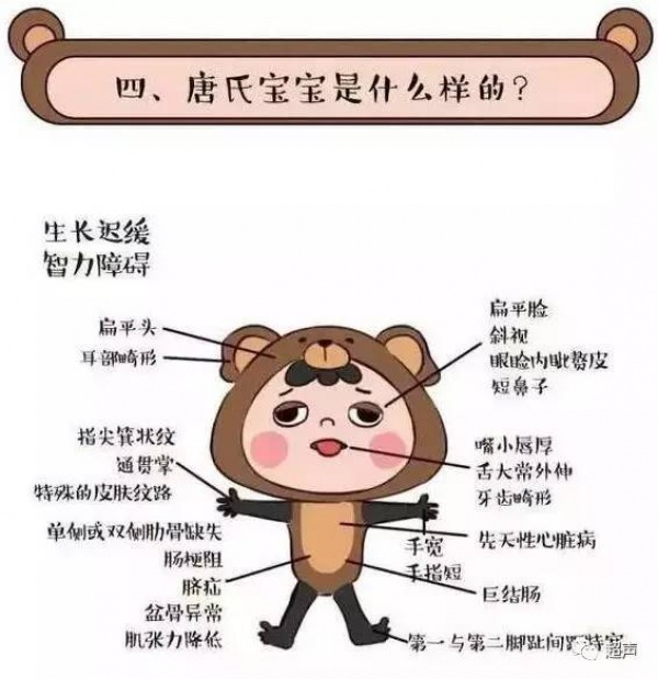 福建一產(chǎn)婦孕期產(chǎn)檢全正常，嬰兒生下來后卻發(fā)現(xiàn)有6種畸形！關(guān)于產(chǎn)檢，這些你必須知道！