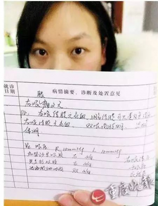 20歲女生因它右眼“暴盲”，能把這個壞習(xí)慣改掉的請舉手……