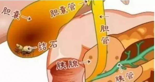 30多歲切除膽囊，原北大醫(yī)院院長：這些習(xí)慣很要命！年輕人幾乎條條都中